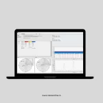 TB 208 - Balancer (Phonovibe D) - Image 2